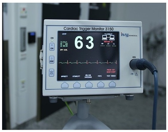 monitor electrocardiograma (ECGEKG) latido corazón