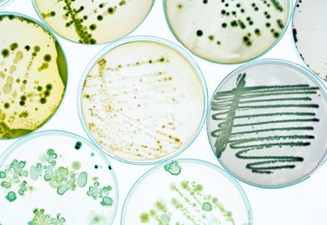la kombucha en estudio - crecimiento de cepas bacterianas en placas petri